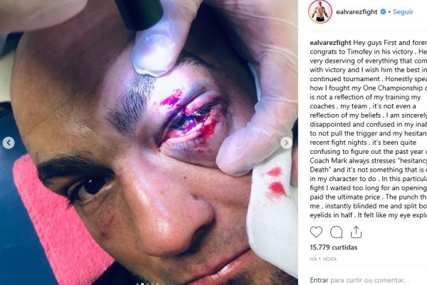 Eddie Alvarez quebra silêncio e exibe olho desfigurado após derrota no ONE; veja