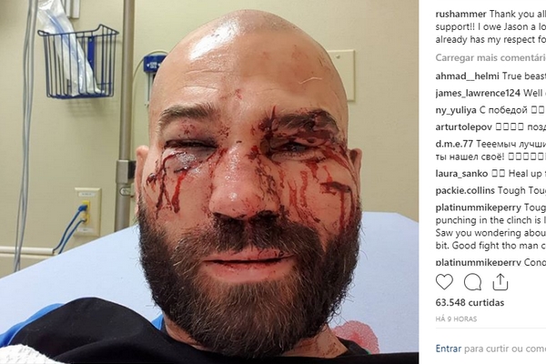 Ex-UFC, amigo de McGregor estreia com vitória no boxe sem luvas