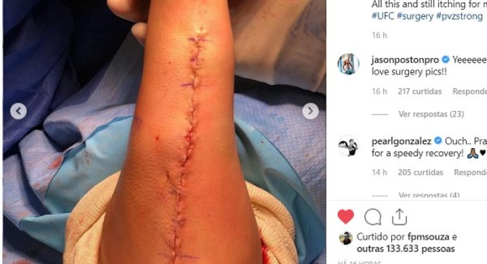 Imagens fortes! Paige VanZant mostra detalhes da terceira cirurgia no braço