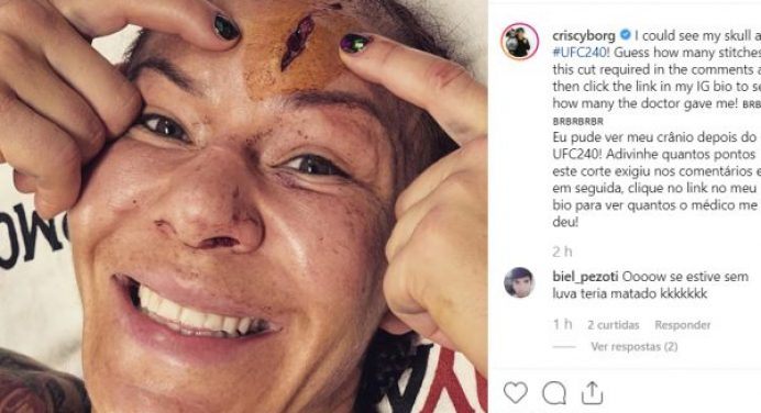 Cris ‘Cyborg’ exibe corte profundo na testa após luta do UFC 240; veja