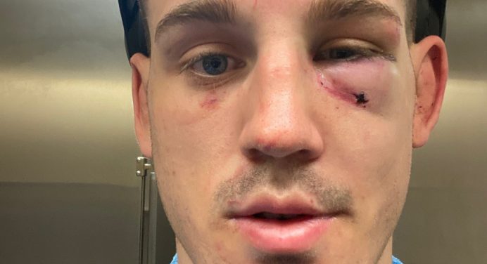 Apesar de vitória no UFC, americano sofre múltiplas fraturas e só deve voltar em 2021