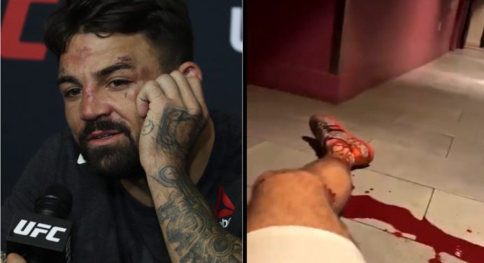 Mike Perry preocupa seguidores ao postar vídeo ensanguentado e mensagem misteriosa