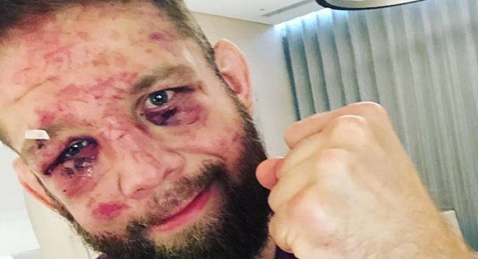 Derrotado no UFC 257, veterano anuncia aposentadoria após perder 40% da visão