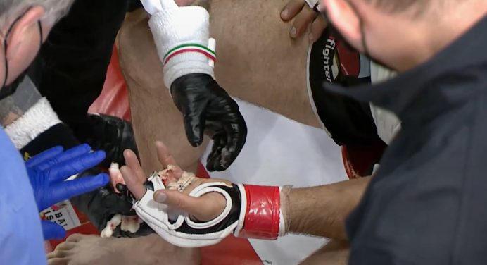 Impressionante! Canadense perde o dedo durante luta de MMA; veja