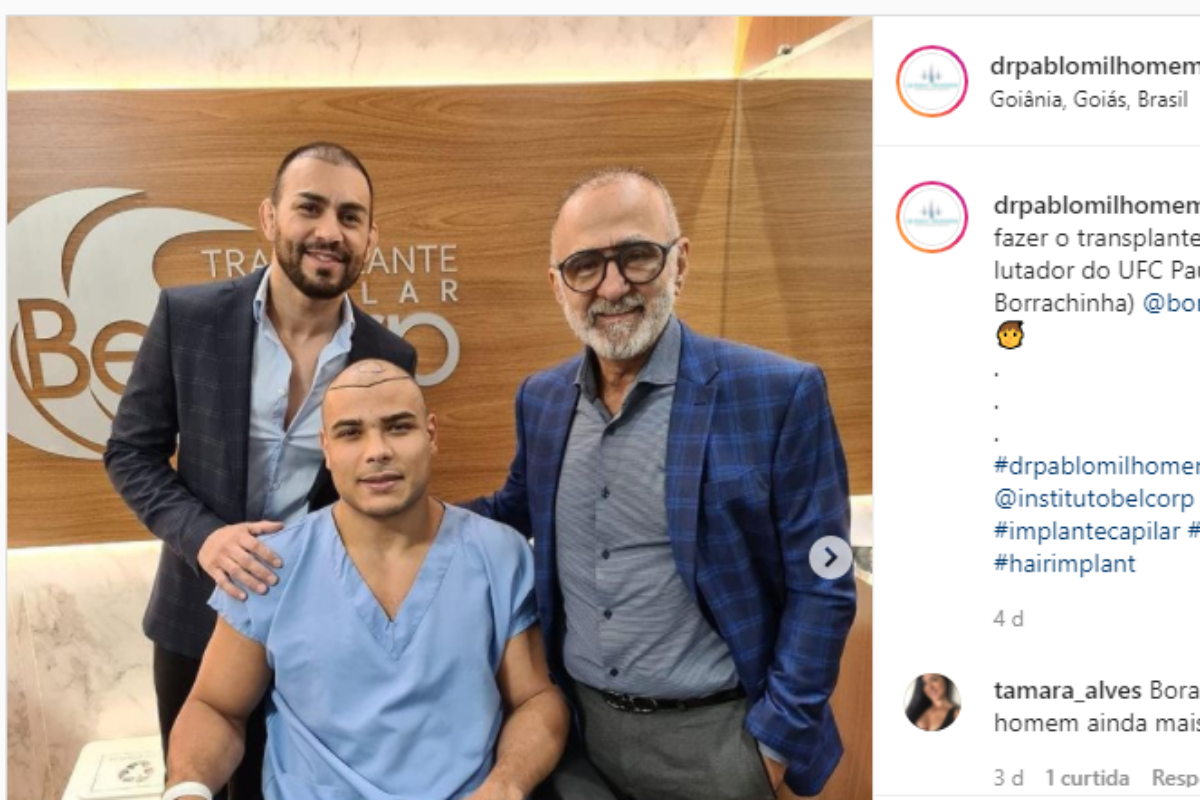 Em litígio com o UFC, ‘Borrachinha’ passa por cirurgia de transplante capilar