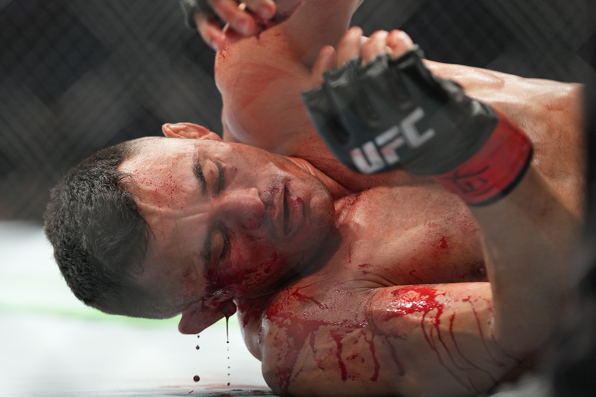 Após vitória no UFC 271, Douglas D’Silva leva pontos em corte no supercílio; veja