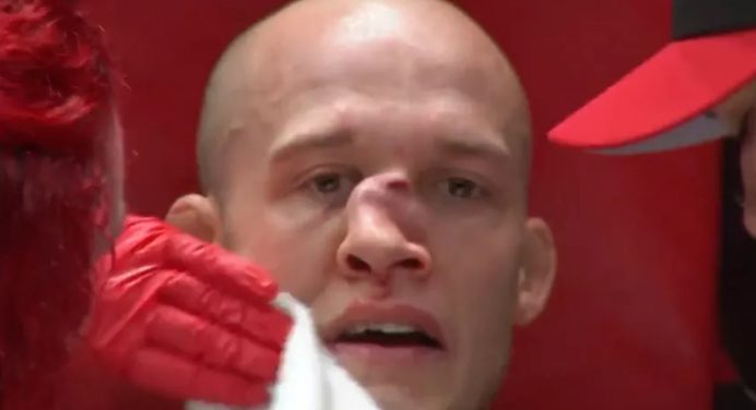 Lutador quebra o nariz de forma assustadora em evento de Urijah Faber; veja