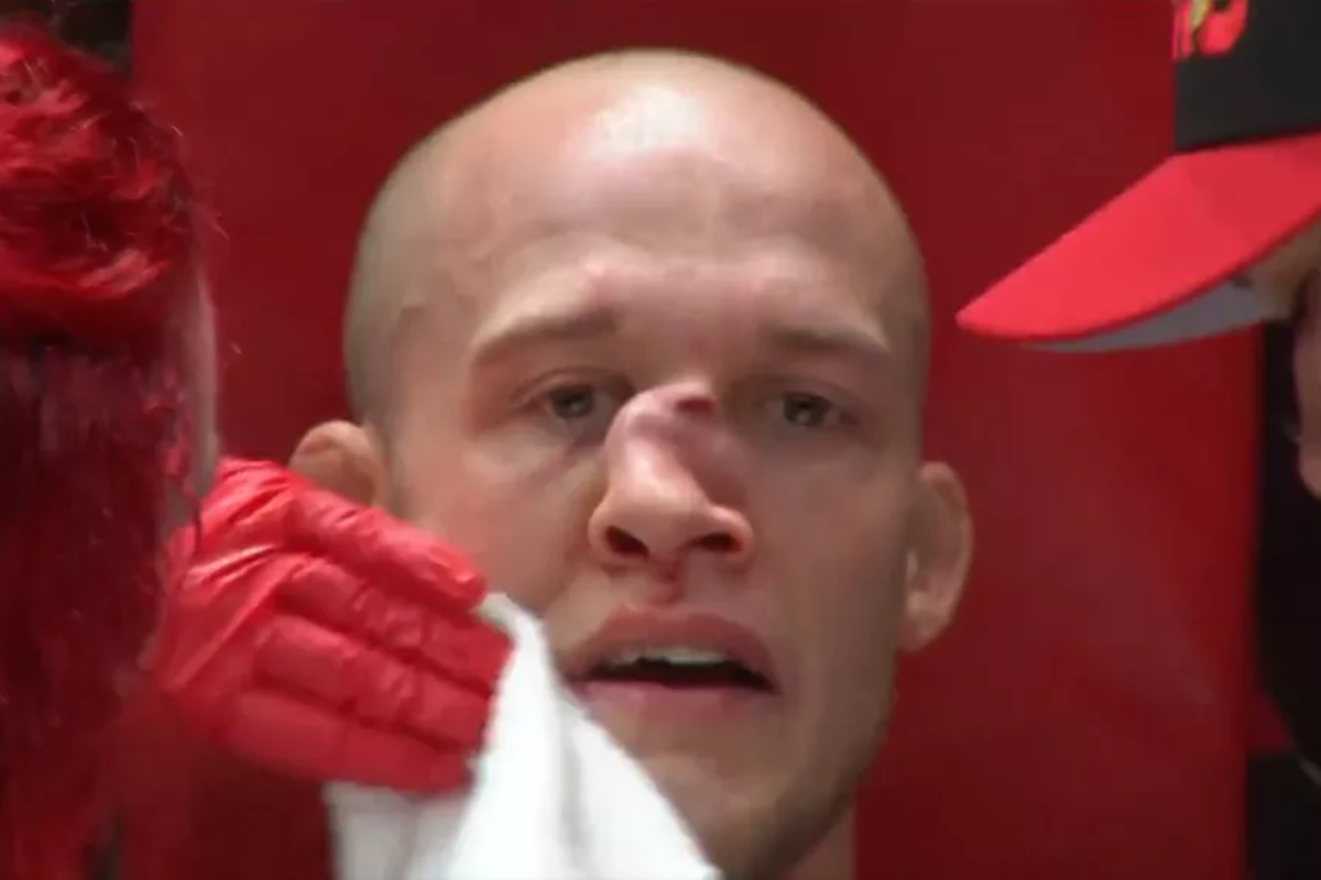 Lutador quebra o nariz de forma assustadora em evento de Urijah Faber; veja