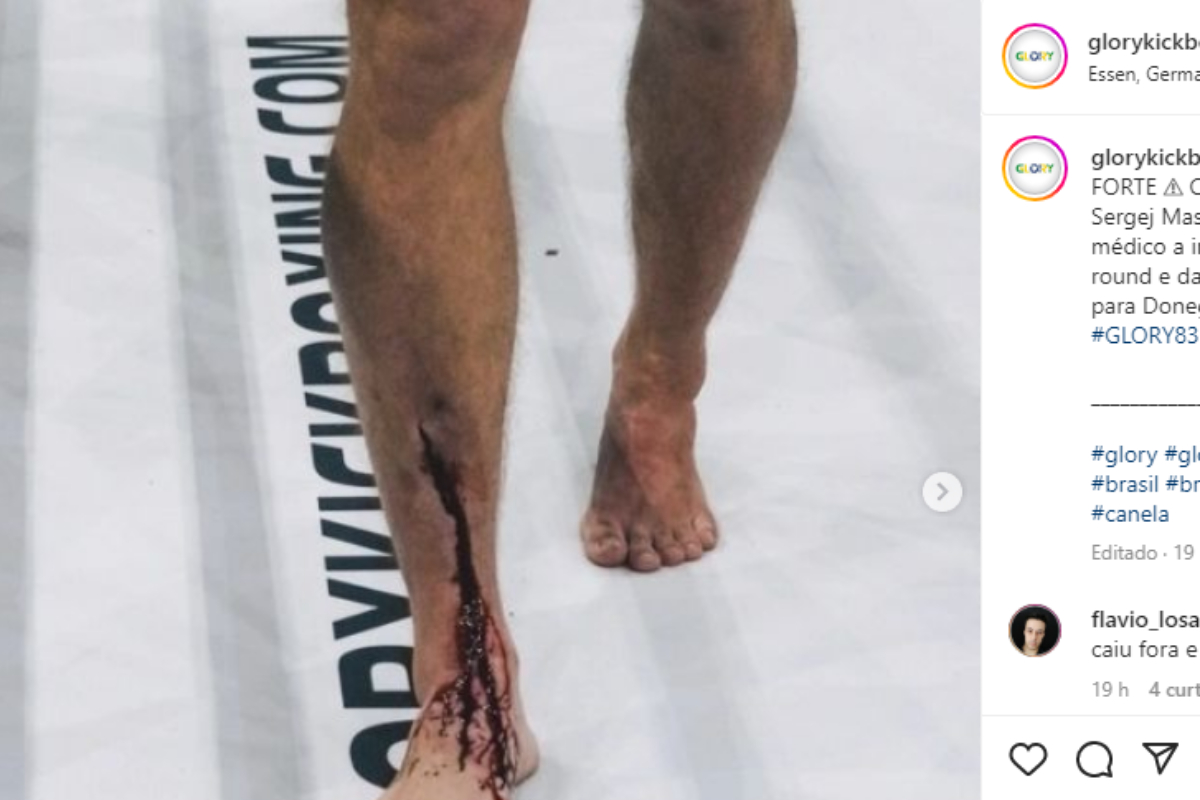 Campeão do Glory perde título após sofrer corte profundo na perna; veja