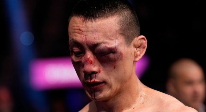 Lutador do UFC sai com rosto desfigurado após enfrentar ‘Novo McGregor’; veja