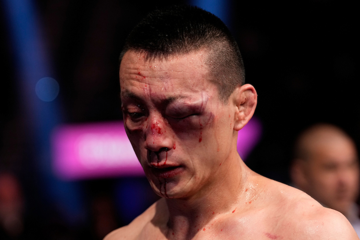 Lutador do UFC sai com rosto desfigurado após enfrentar ‘Novo McGregor’; veja