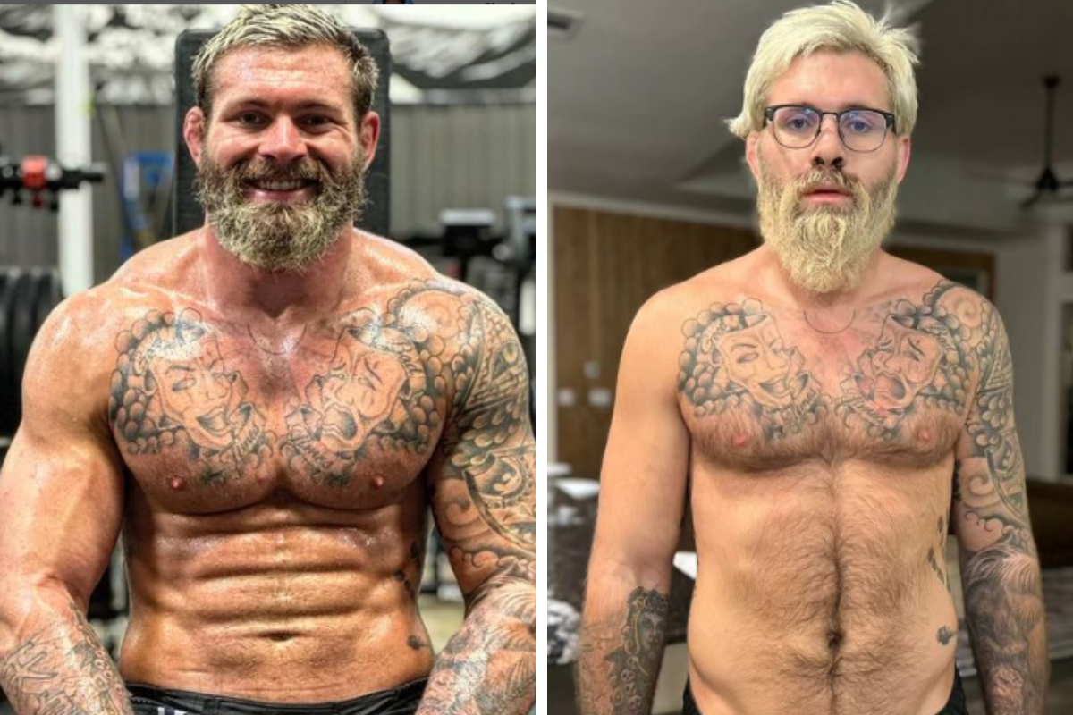 Gordon Ryan antes e depois do problema de saúde que o fez passar por cirurgia e pausar a carreira.