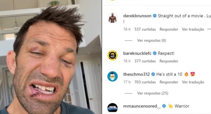 Ex-campeão do UFC descarta aposentadoria após derrota e grave lesão no boxe sem luvas