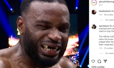 Ulric Bokeme perde múltiplos dentes durante luta no Glory