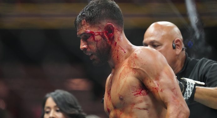 Yair Rodriguez se pronuncia após derrota no UFC 290 e promete volta por cima