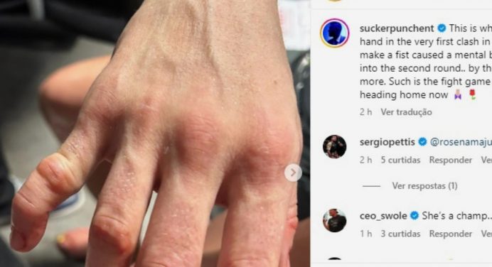 Equipe divulga imagem da lesão sofrida por Namajunas durante luta no UFC Paris