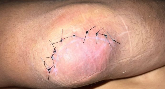 Fisioterapeuta descarta erro de Borrachinha para luta com Chimaev ser cancelada