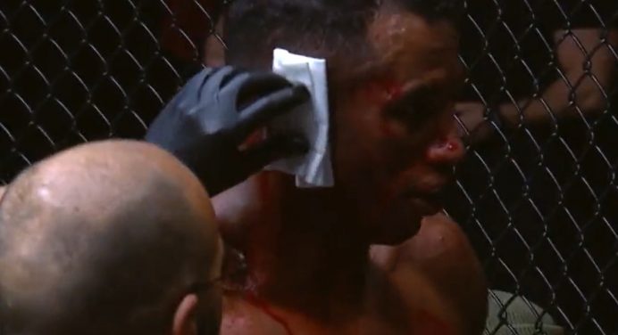 Imagem forte! Brasileiro sofre lesão grave na orelha em evento na Rússia; veja