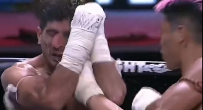 Brutal! Lutador destrói nariz de rival em combate de muay thai; veja