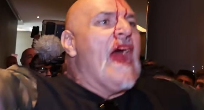 Pai de Tyson Fury dá cabeçada em membro de equipe rival e deixa confusão ensanguentado; veja