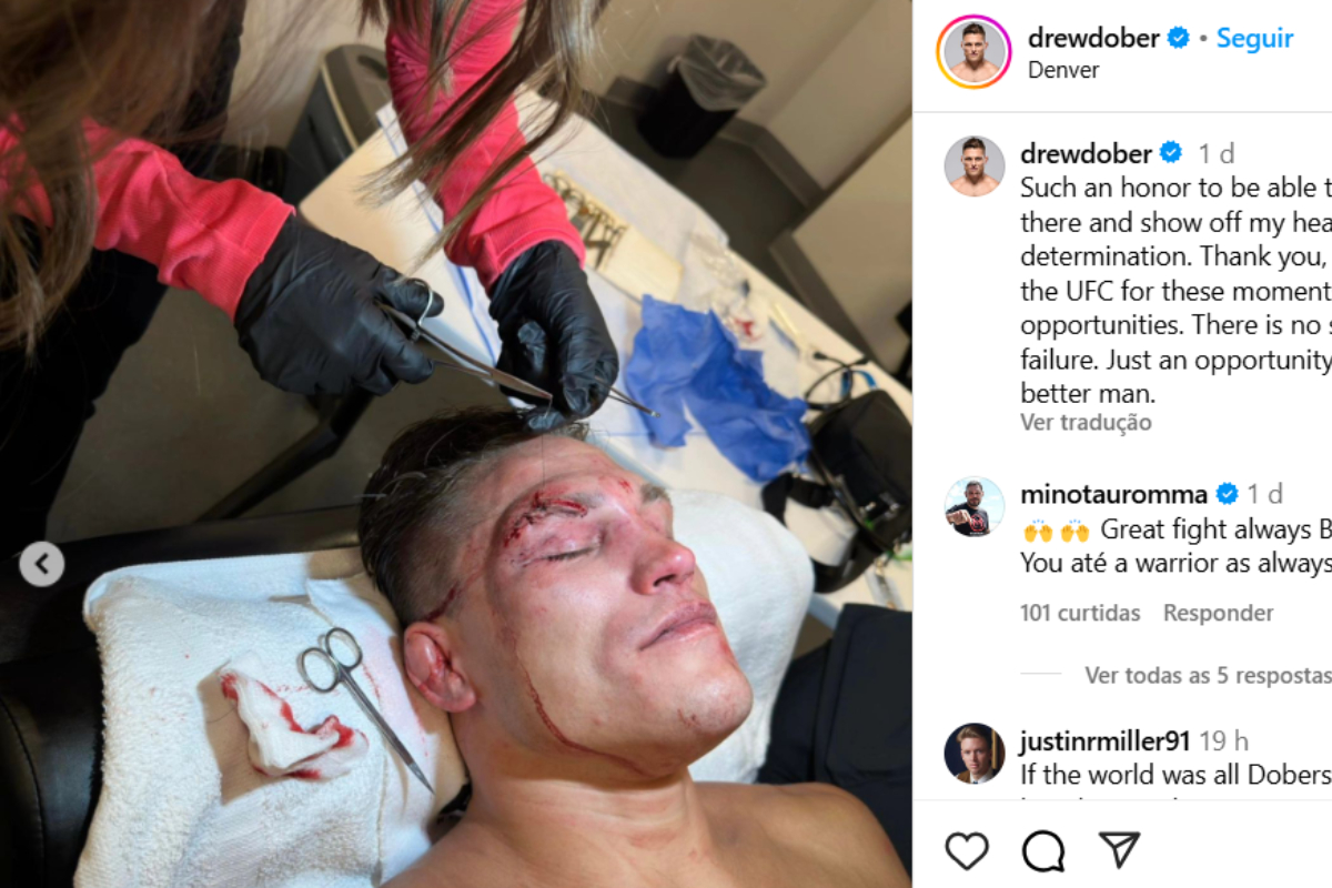 Drew Dober recebe pontos no supercílio após derrota para Jean Silva no UFC Denver.