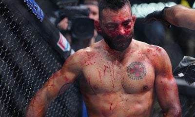 Benoit Saint Denis com o rosto desfigurado e ensanguentado após derrota para Renato Moicano no UFC Paris.