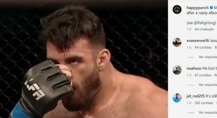 Lutador ‘conserta’ nariz quebrado durante combate no LFA; veja