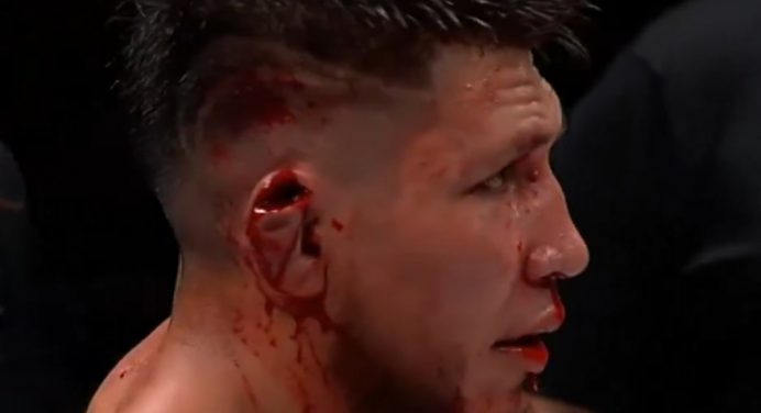 Ex-Contender Series sofre lesão grotesca na orelha em evento nos EUA; veja