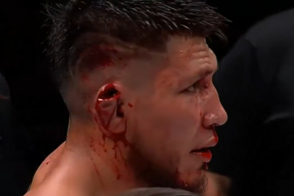 Zach Borrego sofreu uma lesão feia na orelha