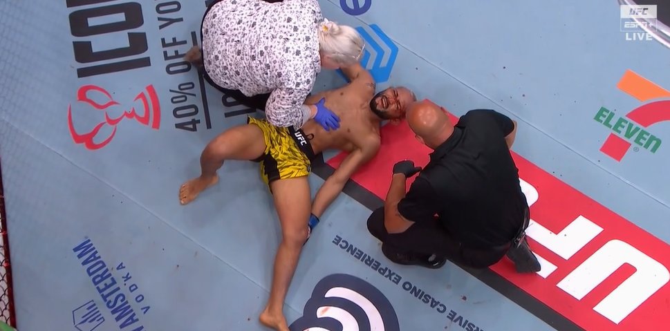 Deiveson Figueiredo deitado com a mão no joelho após lesão no UFC Des Moines