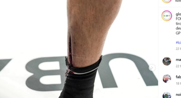 Imagem forte! Lutador sofre corte feio na canela em luta de kickboxing; veja