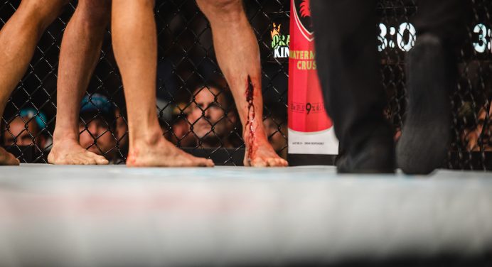 Imagem forte! Wonderboy explica gravidade de corte na canela após o UFC: “Até o osso”