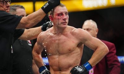 Paddy Pimblett ensanguentado no intervalo do duelo no UFC 324